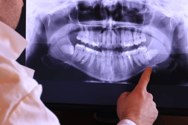 Best Emergency Treatment for Jaw Pain or Injury in Hillandale, MD