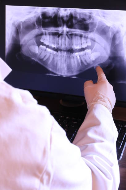 Best Emergency Treatment for Oral Infections in Hillandale, MD